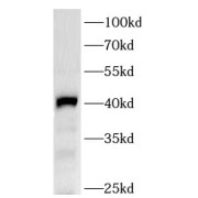 WB analysis of RFP tagged protein, using RFP antibody (1/3000 dilution).