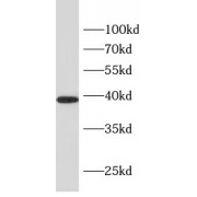 WB analysis of human blood, using GYPA antibody (1/1000 dilution).