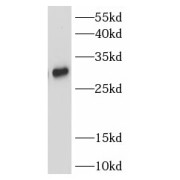 WB analysis of Human plasma, using TIGIT antibody (1/1000 dilution).