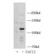 WB analysis of HepG2 cells, using HI2FA antibody (1/1000 dilution).