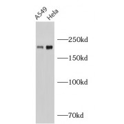 WB analysis of various lysates, using PTPRF antibody (1/1000 dilution).