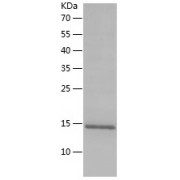 Monkeypox Virus A29L (Mpox A29L) Protein