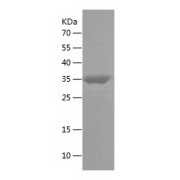 WB analysis of recombinant Human NPHS2 protein.