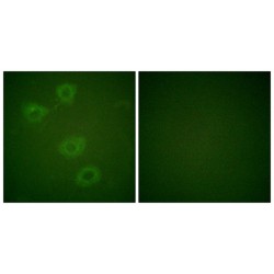 Tyrosine Hydroxylase (Phospho-Ser19) Antibody