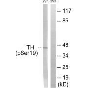 Western blot analysis of extracts from 293 cells, treated with Insulin (0.01U/ml, 30mins), using Tyrosine Hydroxylase (Phospho-Ser19) antibody.