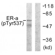 Western blot analysis of extracts from 293 cells, using Estrogen Receptor- alpha (Phospho-Tyr537) antibody. The lane on the right is treated with synthetic peptide.