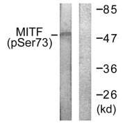 Western blot analysis of extracts from COS7 cells, using MITF (Phospho-Ser180/73) antibody.