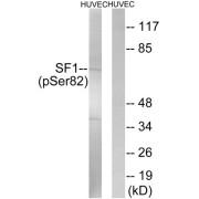 Western blot analysis of extracts from HUVEC cells, treated with anisomycin (25ug/ml, 30mins), using SF1 (Phospho-Ser82) antibody.