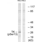 Western blot analysis of extracts from HeLa cells, treated with paclitaxel (1uM, 24hours), using TK (Phospho-Ser13) antibody.