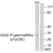 Western blot analysis of extracts from K562 cells, treated with PMA (125 ng/ml, 30 mins), using CD32 (Phospho-Tyr292) antibody.