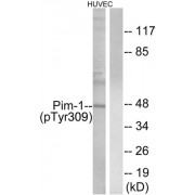Western blot analysis of extracts from HUVEC cells, treated with PMA (125ng/ml, 30mins), using Pim-1 (Phospho-Tyr309) antibody.