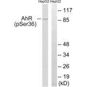 Western blot analysis of extracts from HepG2 cells, using AhR (Phospho-Ser36) antibody.