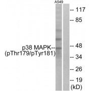 Western blot analysis of extracts from A549 cells, treated with etoposide (25uM, 24hours), using p38 MAPK (Phospho-Thr179+Tyr181) antibody.