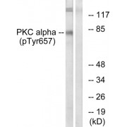 Western blot analysis of extracts from COLO205 cells, using PKC alpha (Phospho-Tyr657) antibody.