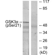 Western blot analysis of extracts from ovary cancer cells. Line1: Using GSK3 alpha (Phospho-Ser21) Antibody; Line2: The same antibody preincubated with synthesized phosphopeptide.