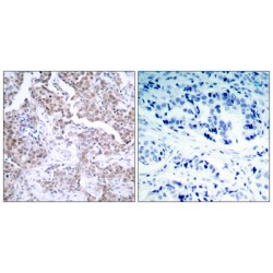 Cellular Tumor Antigen P53 Phospho-Ser15 (TP53 pS15) Antibody