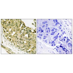 Stathmin 1 Phospho-Ser16 (STMN1 pS16) Antibody