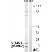 Western blot analysis of extracts from COS cells, treated with nocodazole (1ug/ml, 16hours), using STMN1 (Phospho-Ser62) antibody.