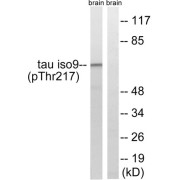 Western blot analysis of extracts from rat brain cells, using Tau (Phospho-Thr534/217) antibody. The lane on the right is blocked with the phosphopeptide.