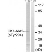Western blot analysis of extracts from HT-29 cells, treated with heat shock, using CK-1 alpha (Phospho-Tyr294) antibody.