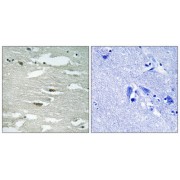 Immunohistochemistry analysis of paraffin-embedded human brain tissue using ILK (Phospho-Ser246) antibody.