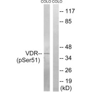 Western blot analysis of extracts from COLO cells, treated with Insulin (0.01U/ml, 15mins), using Vitamin D3 Receptor (Phospho-Ser51) antibody.