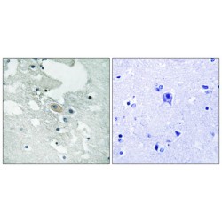 B-Cell Linker Protein Phospho-Tyr84 (BLNK pY84) Antibody