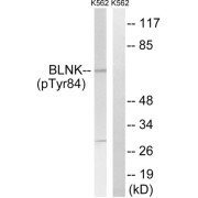 Western blot analysis of extracts from K562 cells, treated with starved (24hours), using BLNK (Phospho-Tyr84) antibody.