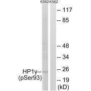 Western blot analysis of extracts from K562 cells, treated with forskolin (40nM, 30mins), using HP1 gamma (Phospho-Ser93) antibody.