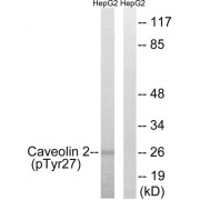 Western blot analysis of extracts from HepG2 cells, treated with EGF (200ng/ml, 5mins), using Caveolin 2 (Phospho-Tyr27) antibody.