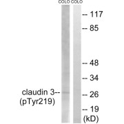 Western blot analysis of extracts from COLO cells, treated with EGF (200ng/ml, 30mins), using Claudin 3 (Phospho-Tyr219) antibody.