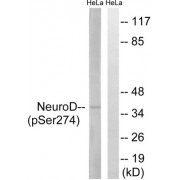 Western blot analysis of extracts from HeLa cells, treated with UV (15 mins), using Neuro D (Phospho-Ser274) antibody. The lane on the right is blocked with the phosphopeptide.