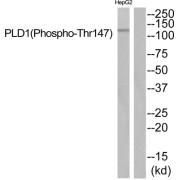 Western blot analysis of extracts from HepG2 cells, using PLD1 (Phospho-Thr147) antibody.