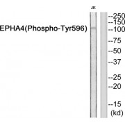 Western blot analysis of extracts from JurKat cells, using EPHA4 (Phospho-Tyr596) antibody.
