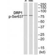 Western blot analysis of extracts from JK cells and K562 cells, using DRP1 (Phospho-Ser637) antibody.
