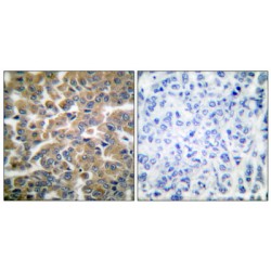 Glutathione Reductase (GR) Antibody