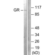 Western blot analysis of extracts from HeLa cells treated with PMA (125ng/ml, 30min), using GR (epitope around residue 211) antibody (abx012759, Line 1 and 2).