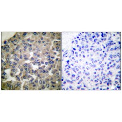 Phospholipase C Gamma 1 (PLCG1) Antibody