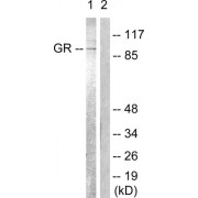 Western blot analysis of extracts from Jurkat cells, treated with EGF (200ng/ml, 15mins), using GR (epitope around residue 226) antibody (abx012772).