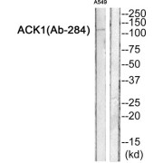 Activated CDC42 Kinase 1 (ACK1) Antibody