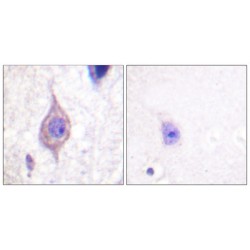 ALK Tyrosine Kinase Receptor (ALK) Antibody