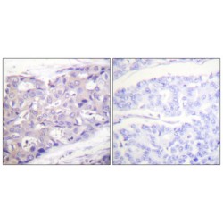 RAC-Alpha Serine/threonine-Protein Kinase (Akt) Antibody