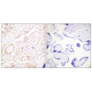 Immunohistochemistry analysis of paraffin-embedded human placenta tissue using GATA3 antibody.