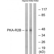 PKA-R2 beta Antibody
