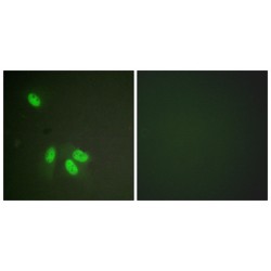 Heterogeneous Nuclear Ribonucleoprotein D0 (hnRPD) Antibody