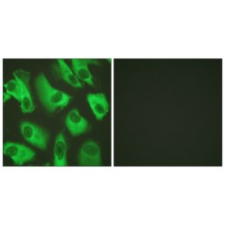 Inward Rectifier Potassium Channel 16 (KCNJ16) Antibody