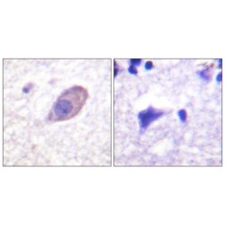 Inward Rectifier Potassium Channel 16 (KCNJ16) Antibody