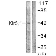 Western blot analysis of extracts from HeLa cells, using Kir5.1 (epitope around residue 416) antibody.