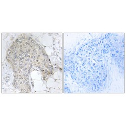 Protein Phosphatase 1 Regulatory Inhibitor Subunit 2 (PPP1R2) Antibody