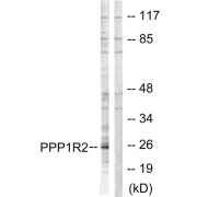 Western blot analysis of extracts from Jurkat cells, using PPP1R2 (epitope around residue 120/121) antibody.